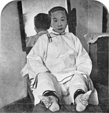 Black and white photograph of a sitting Chinese woman with pointy squished feet